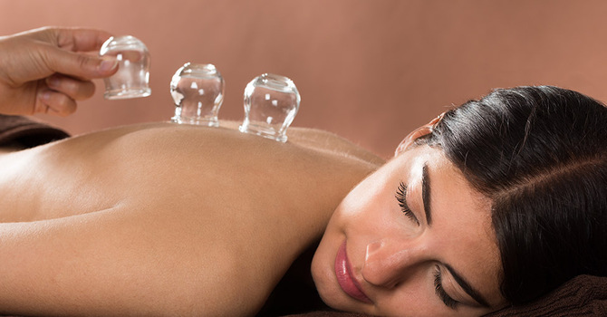 Needle - Free TCM Services: Cupping & Ear Seed Therapy